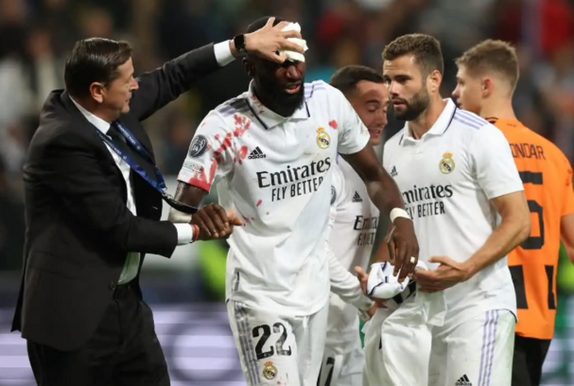 皇家马德里重手除暴，贝尔空门破绽